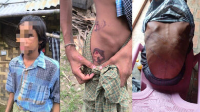 Maung Maung, 15, shows his injuries after escaping from pro-regime Pyu Saw Htee forces on September 12 (Photo: Kyunhla-Kanbalu Activists Group)
