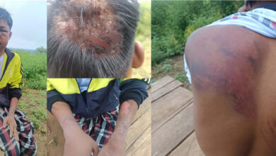 Resistance members treating Kyaw Myo’s injuries after his escape (Photo: KBL PDF)