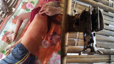 -ဗုံးစထိမှန်၍ သေဆုံးသွားသည့် မောင်သက်ပိုင်ဇော်နှင့် လက်နက်အပိုင်းအစတစ်ခု။ (ဓာတ်ပုံ-ပေးပို့)