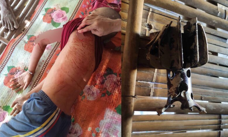 -ဗုံးစထိမှန်၍ သေဆုံးသွားသည့် မောင်သက်ပိုင်ဇော်နှင့် လက်နက်အပိုင်းအစတစ်ခု။ (ဓာတ်ပုံ-ပေးပို့)