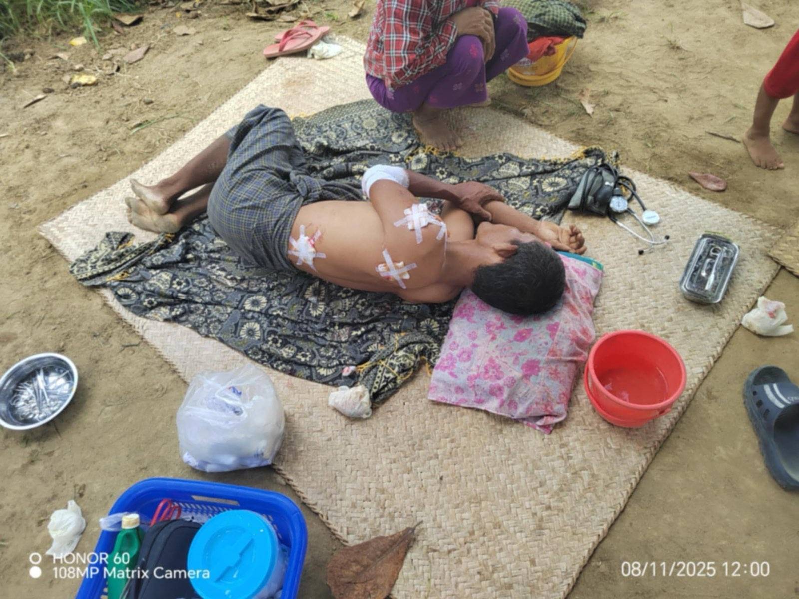 ဒဏ်ရာရသူအမျိုးသားတစ်ဦးကို ဆေးကုသပေးနေစဉ်။ (ဓာတ်ပုံ-ပေးပို့)
