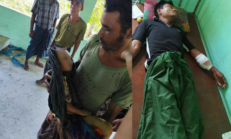 -ယမန်နေ့ မွန်းလွဲက စစ်တပ်၏ လက်နက်ကြီးပစ်ခတ်မှုကြောင့် သေဆုံးခဲ့သည့် ပေါက်တောမြို့နယ်၊ တောင်ညိုရွာမှ မဇင်ချိုအိ (၅ နှစ်)နှင့် ဒဏ်ရာရသွားသော ဖခင်ဖြစ်သူ ကိုနေဇော်ထွန်း (၃၀ နှစ်)တို့ကို တွေ့ရစဉ်။ (ဓာတ်ပုံ-ပေးပို့)