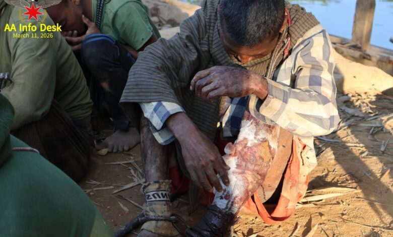 ဗုံးကြဲတိုက်ခိုက်မှုအတွင်း ဒဏ်ရာရသွားသော စစ်သုံ့ပန်းအချို့။ (ဓာတ်ပုံ-AA Info Desk)