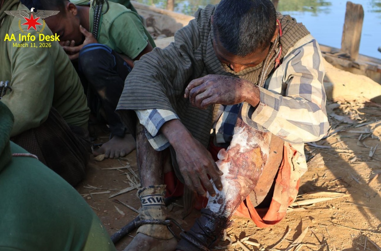 ဗုံးကြဲတိုက်ခိုက်မှုအတွင်း ဒဏ်ရာရသွားသော စစ်သုံ့ပန်းအချို့။ (ဓာတ်ပုံ-AA Info Desk)