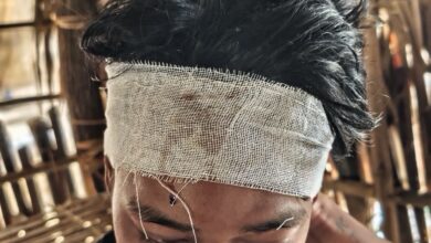 ခိုက်ရန်ဖြစ်စဥ်တွင် ထိခိုက်ဒဏ်ရာရရခဲ့သူ ကိုကျော်သီဟ။ (ပုံ-ပေးပို့)